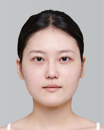 Before Image